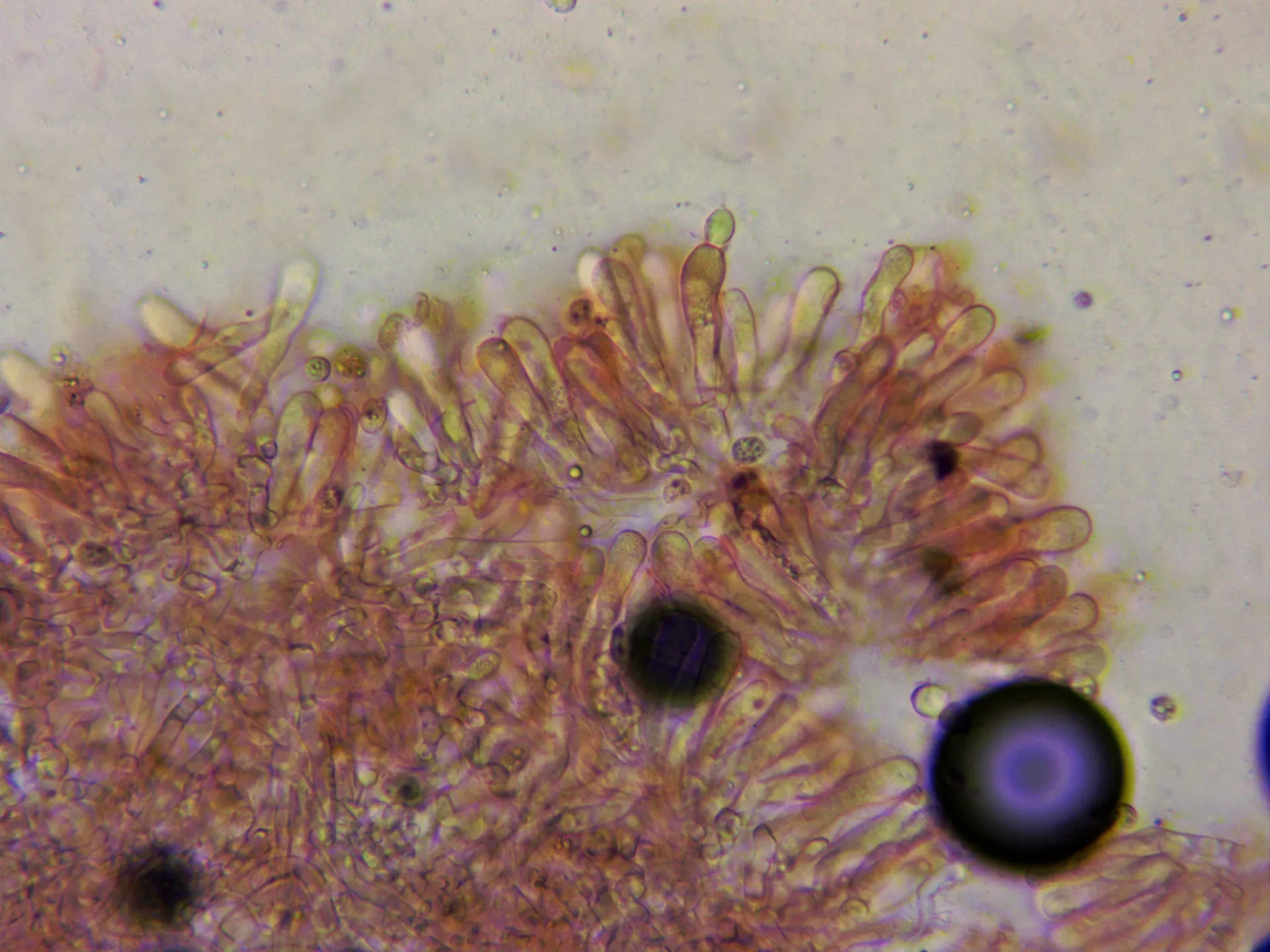 Microscopía de Pseudoclitocybe cyathiformis - 10 - Arista laminar x 400